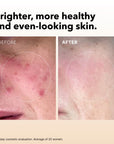 VITAMIN C SERUM-IN-OIL
