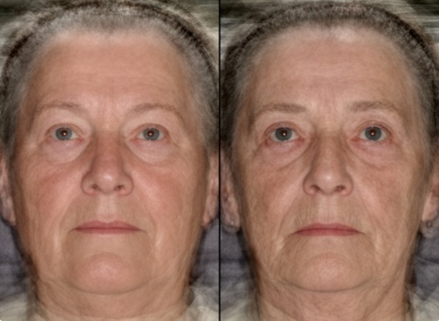 Twins photo from BMJ study