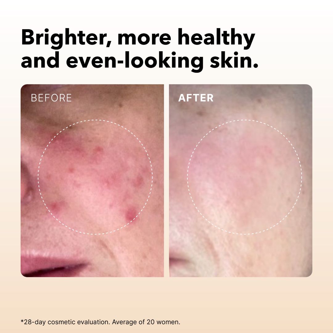 VITAMIN C SERUM-IN-OIL